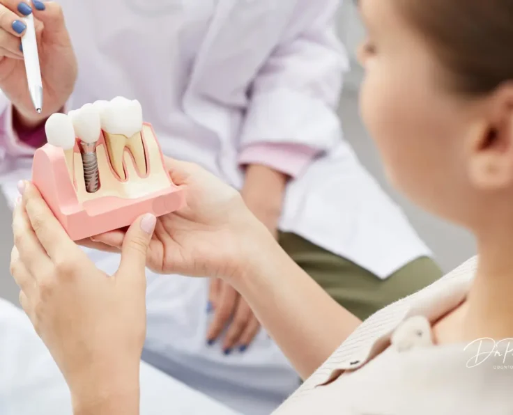 Implantes Dentales en Ciudad Victoria